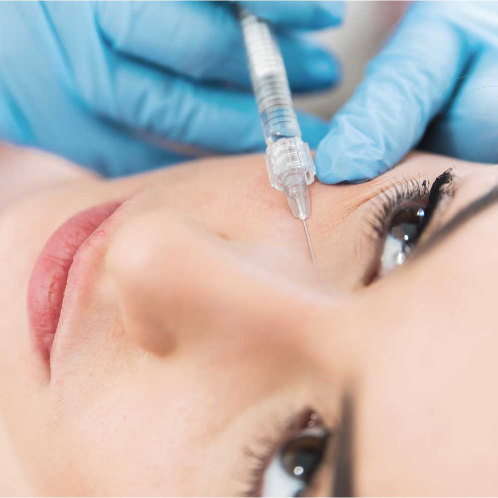 Hyaluron-Unterspritzung-Augen