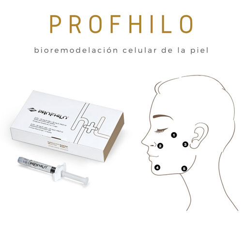 Profhilo Anwendung
